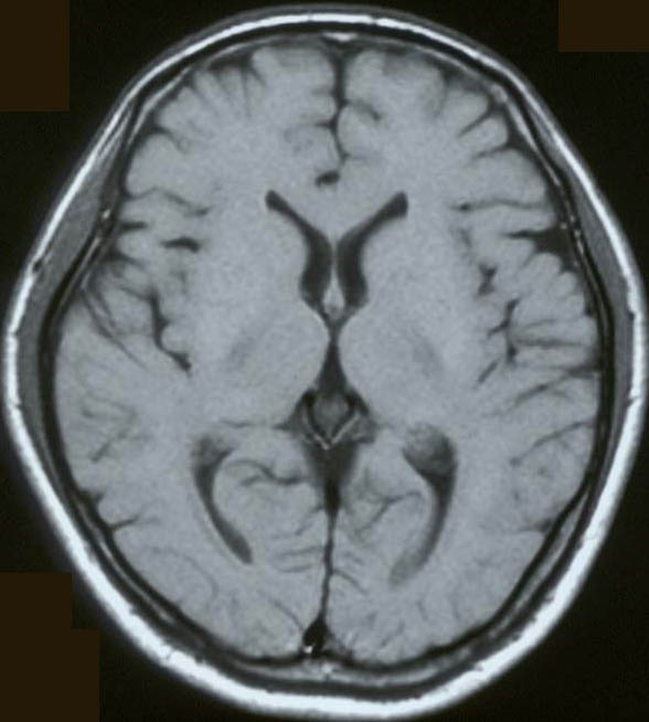 T1-7.jpg (50075 バイト)